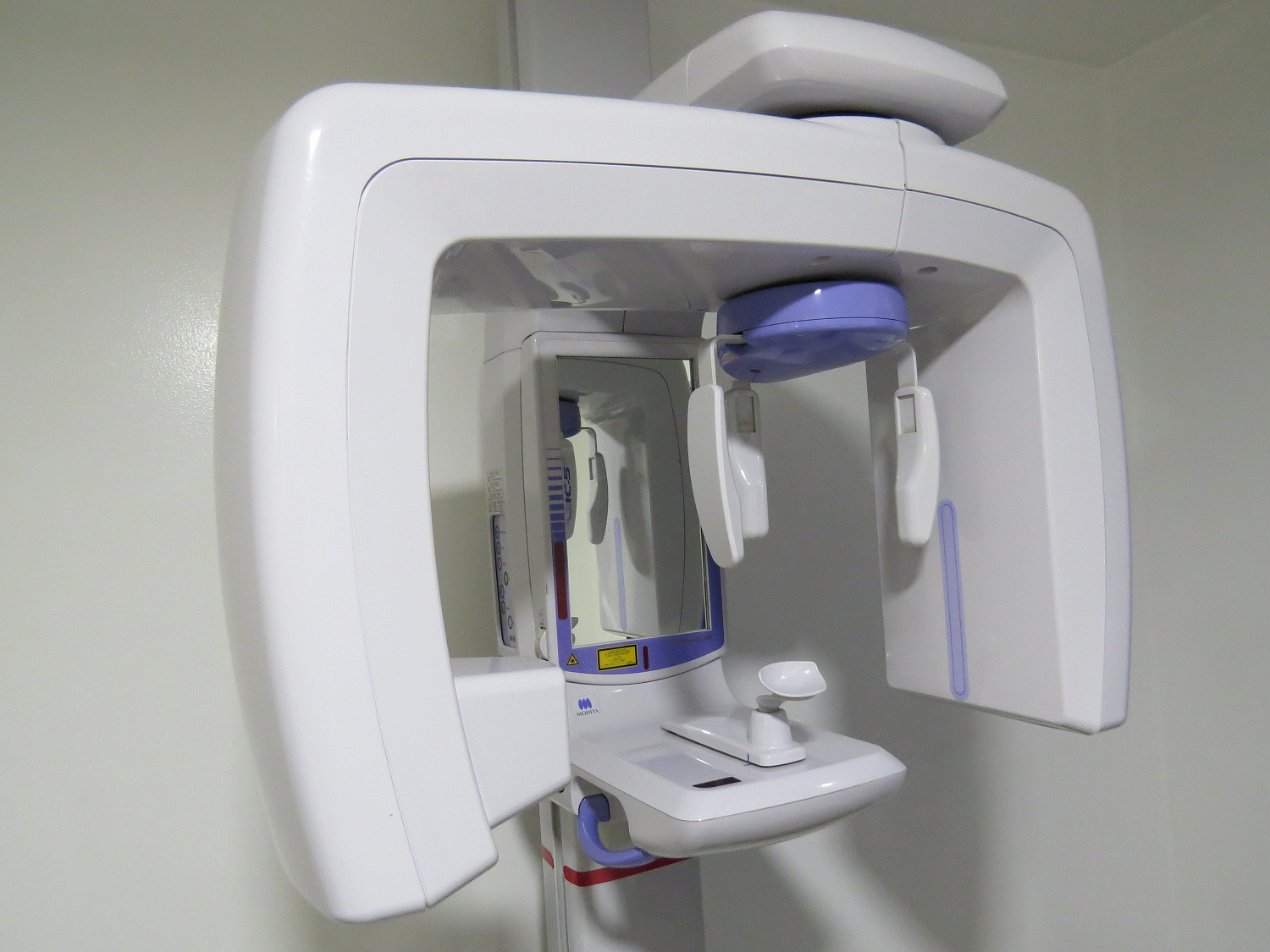 Рентген – просто и быстро!