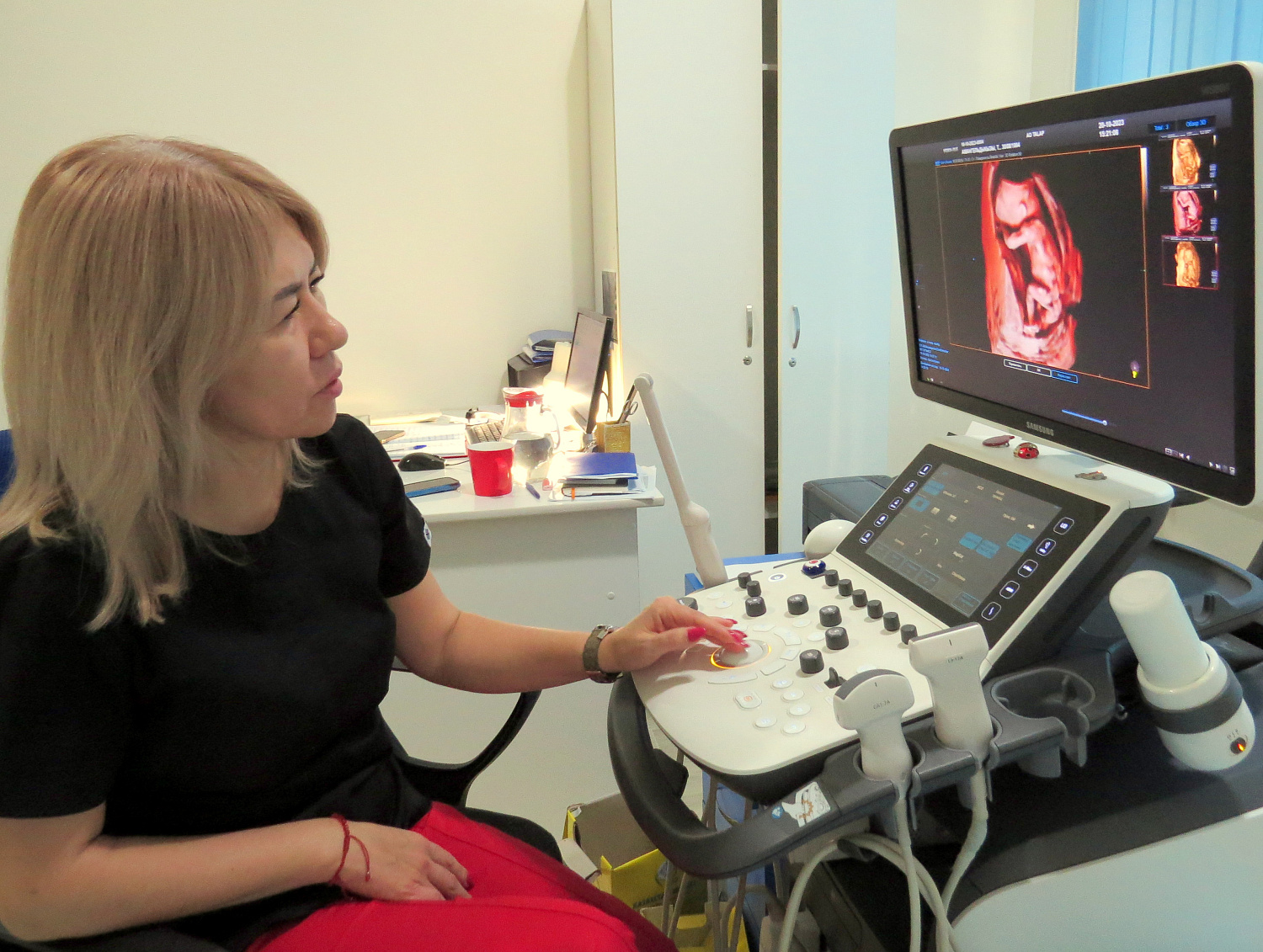 УЗИ – информативный и безопасный метод диагностики