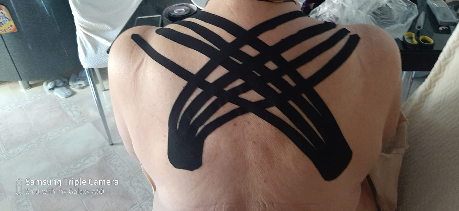 Тейпирование – шаги к здоровью! 